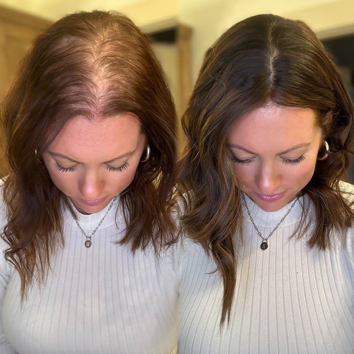 2. Restores Thickness and Growth